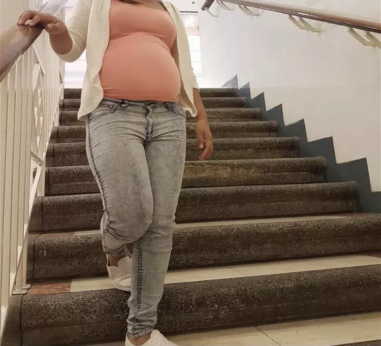 Why do people stare?