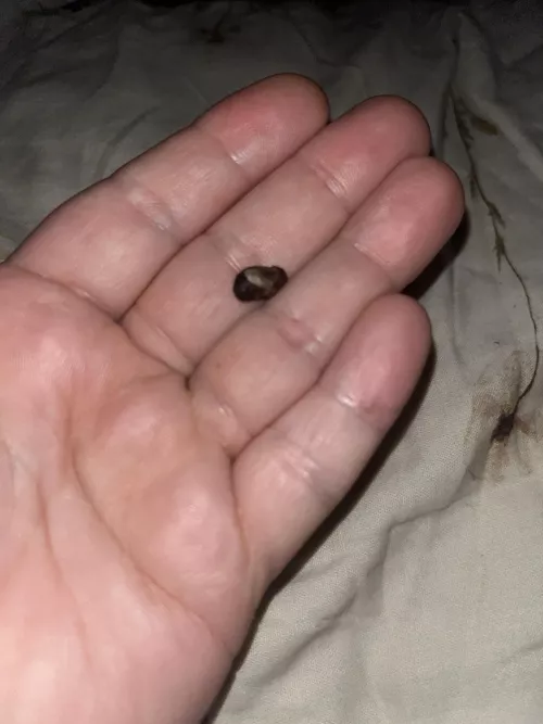 I can finally hear again