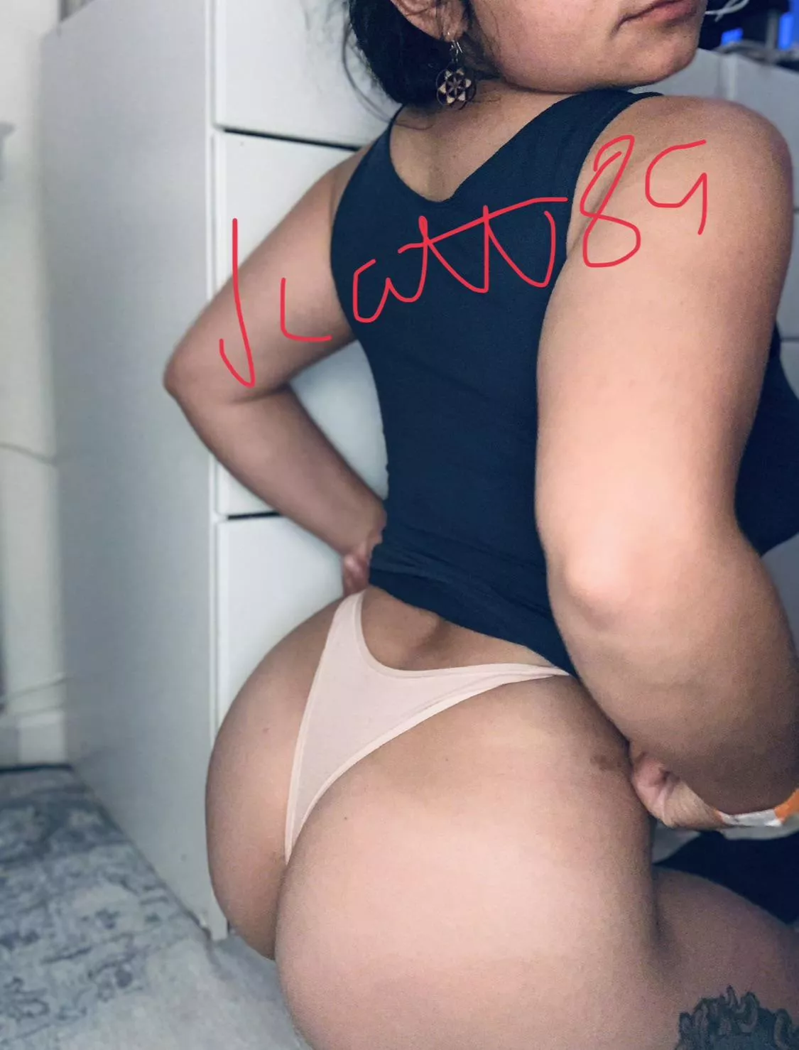 Resurfacing after 4 years (F)