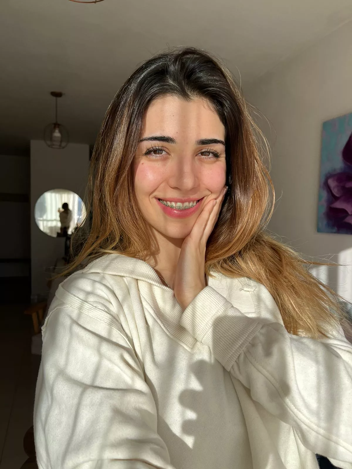 IUTR braces, freckles and dyed hair