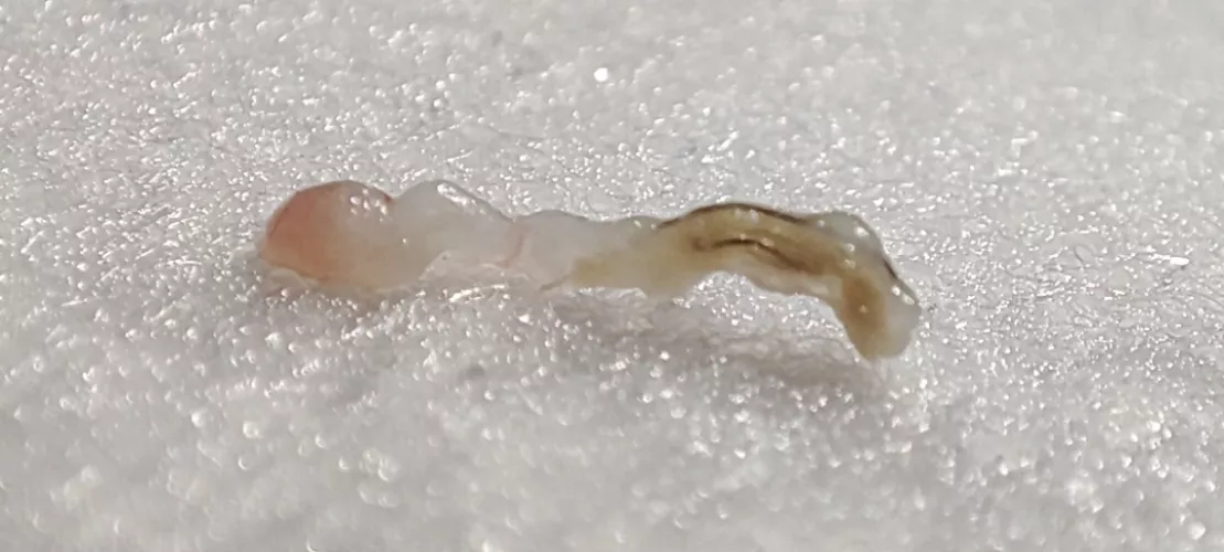 Say hello to my little friend! From my back. Couldn't record the pop.