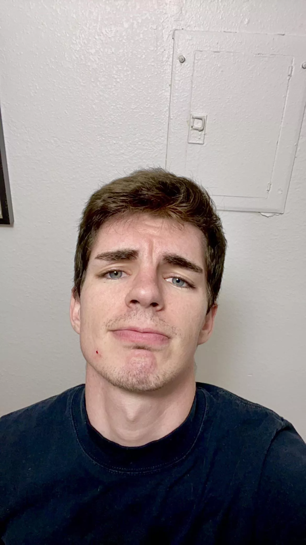 Went to kiss my cat and she scratched me🤕