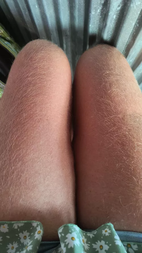 Would you fuck this hairy thigh gap?