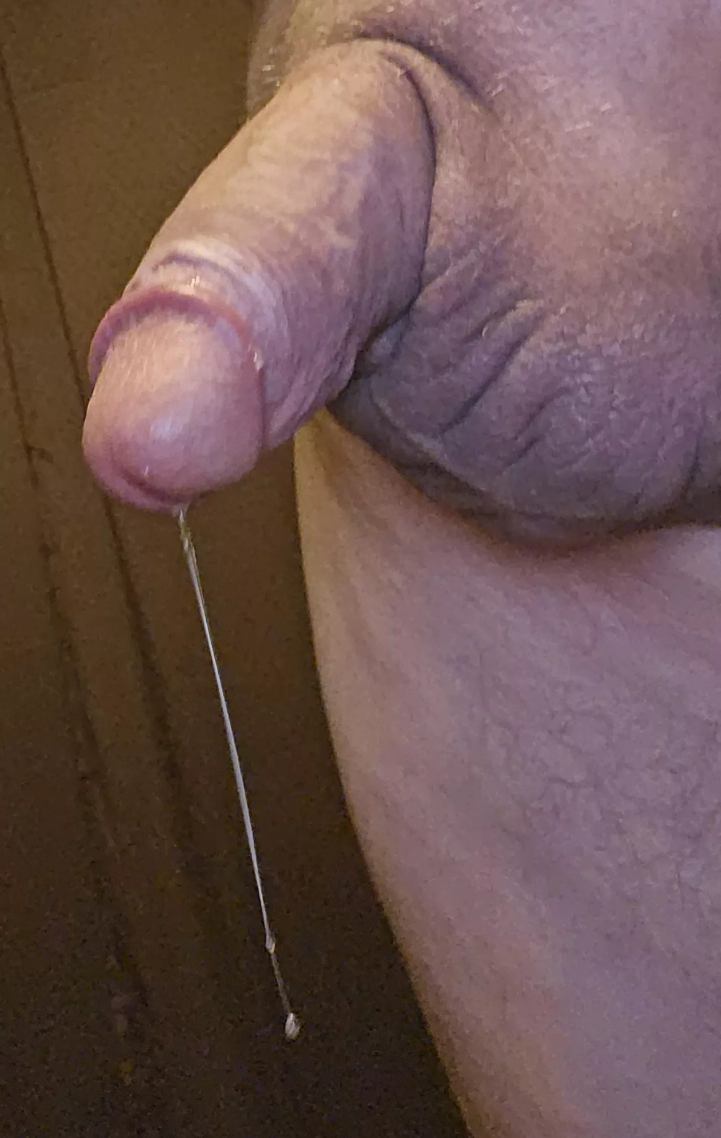 Anyone want to help with this hanging drip?