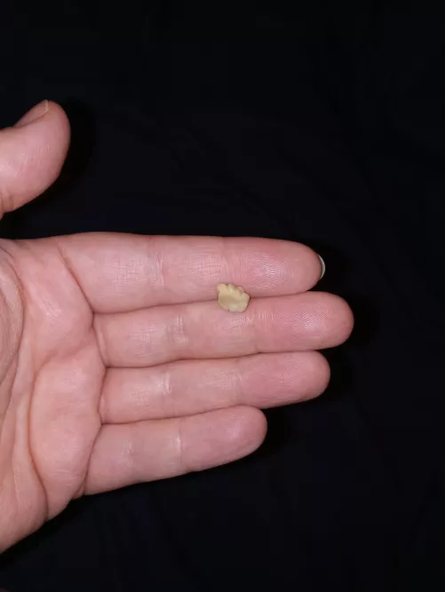 Coughed this up at 5am