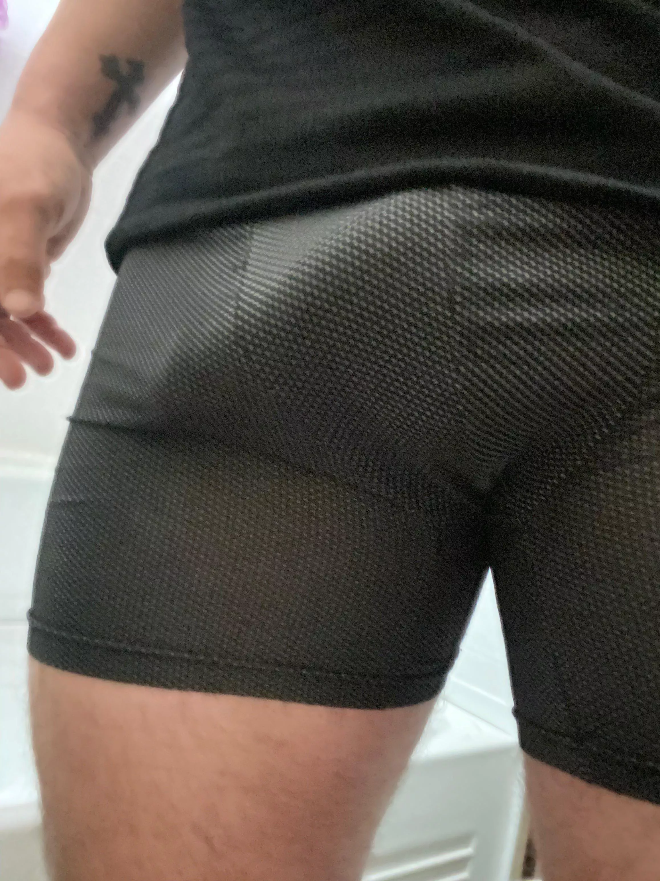 Soft bulge