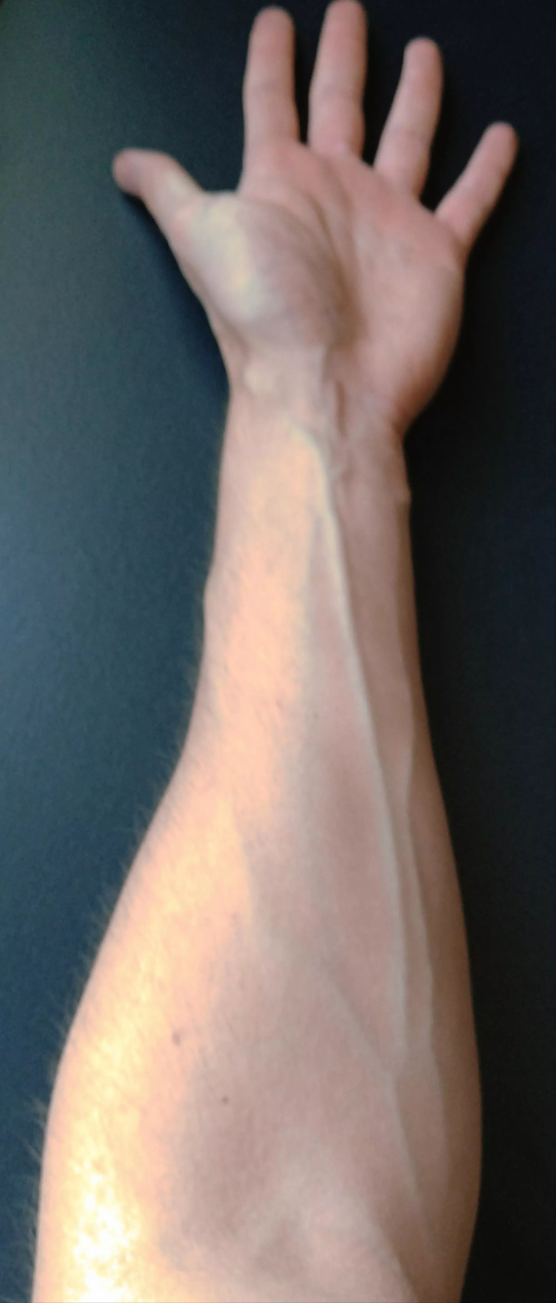 Any love for veins?