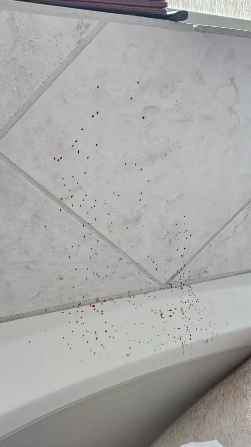 Bathtub boil mishap(blood)
