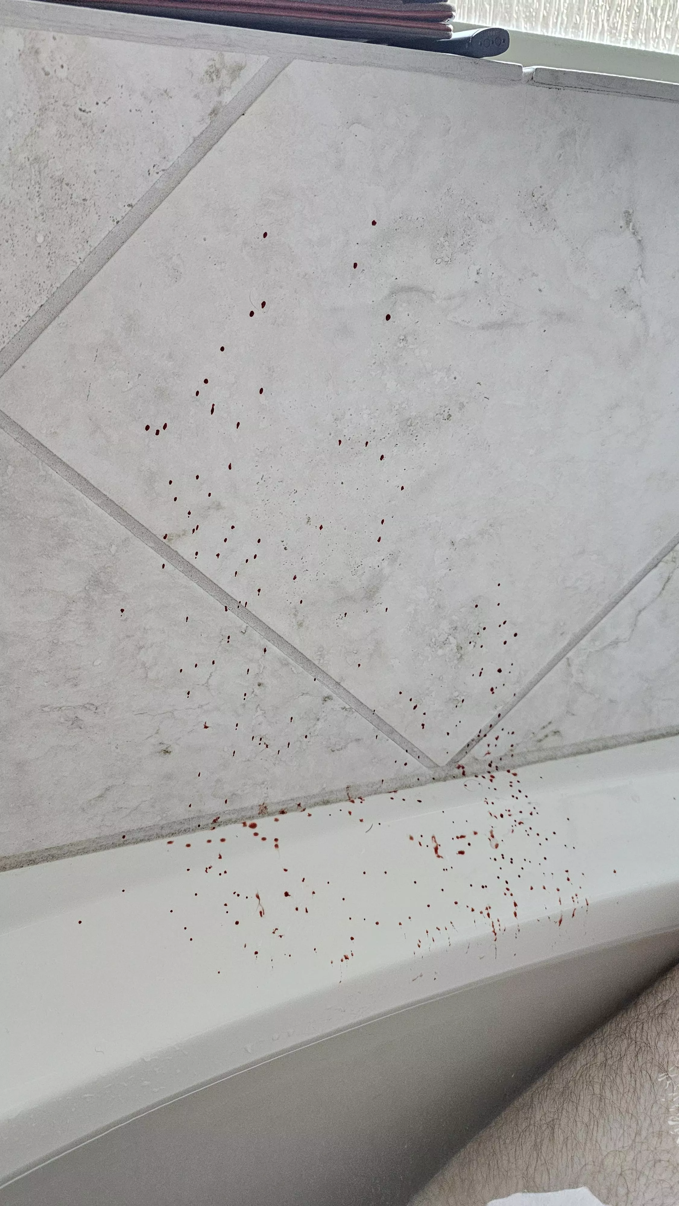 Bathtub boil mishap(blood)