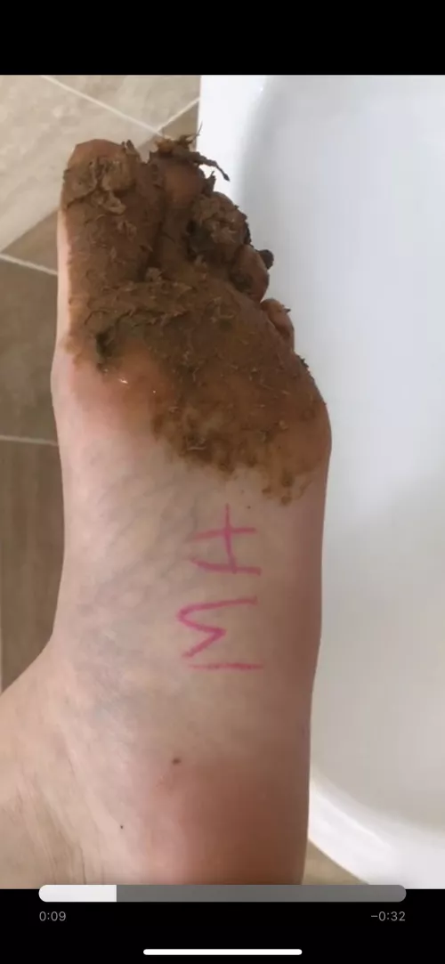 Poop,puke and more …