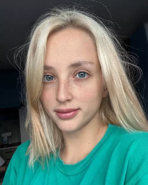 Ex boyfriend said he hated my freckles