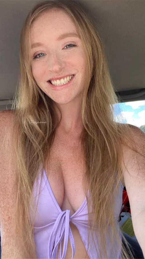 Are freckles a turn off