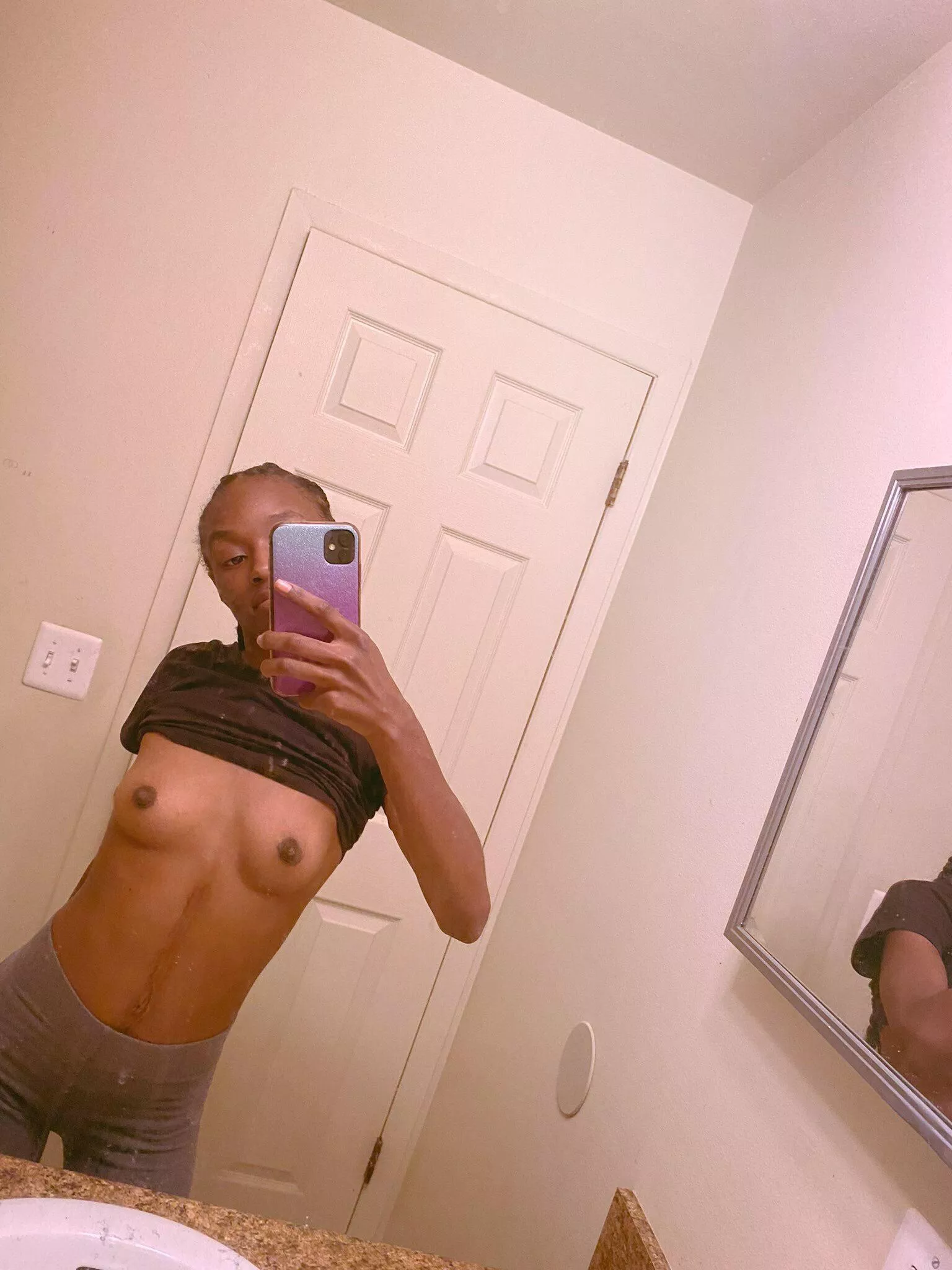 Feeling cute with my scar