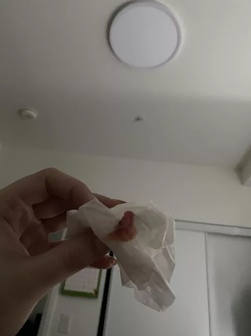 Blew this out of my nose today. Pretty sure I have Covid.