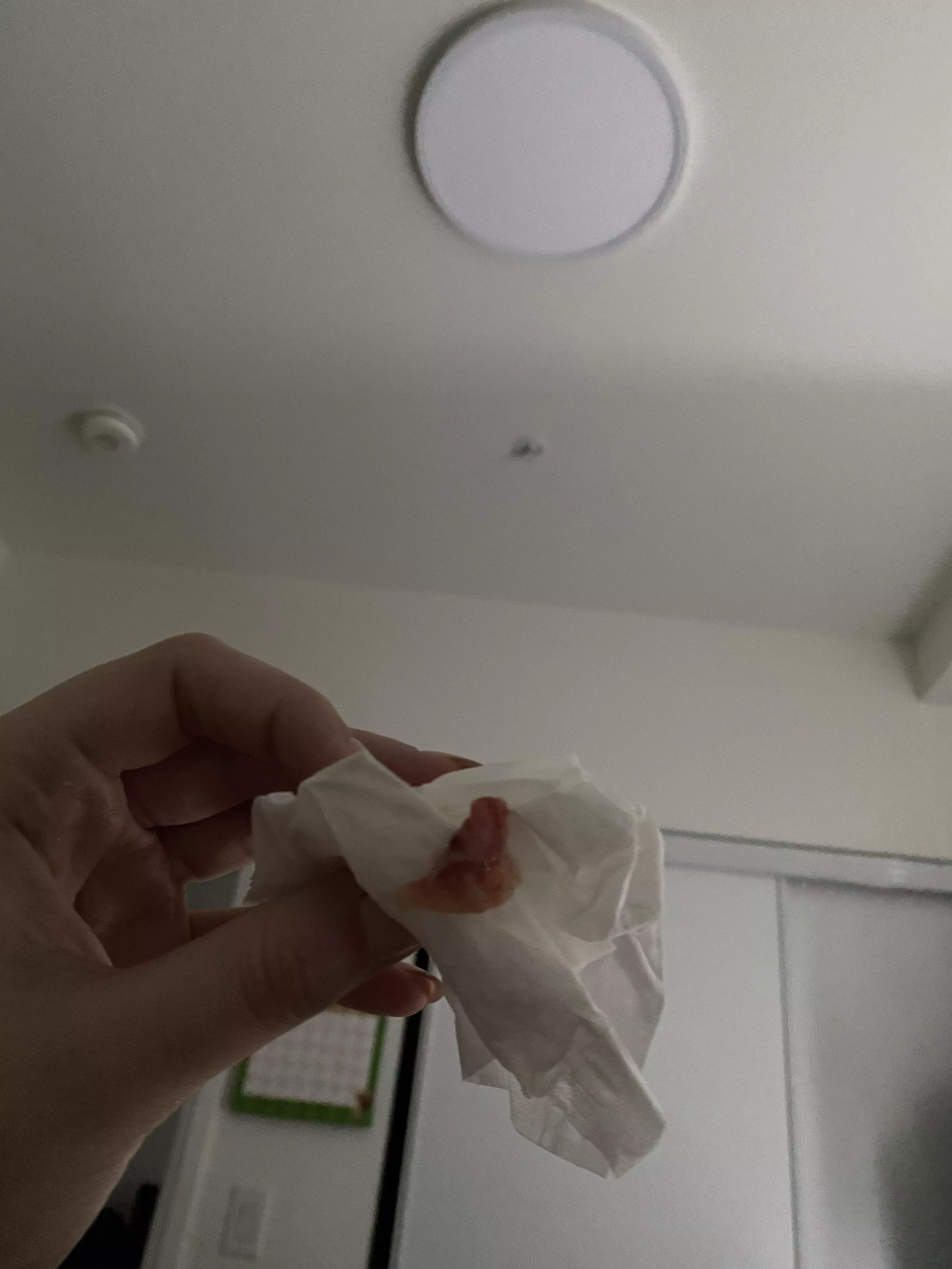 Blew this out of my nose today. Pretty sure I have Covid.