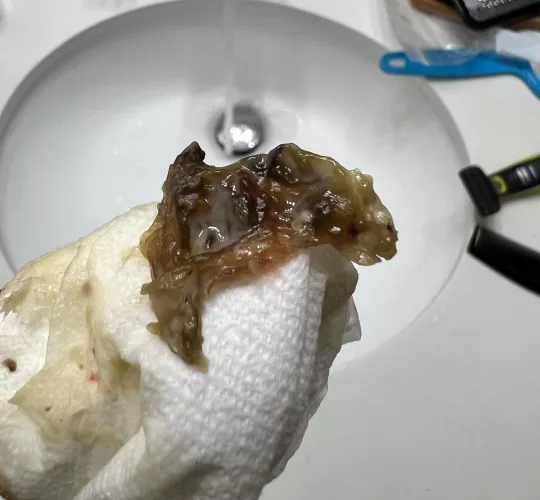 Endoscopic Sinus Surgery