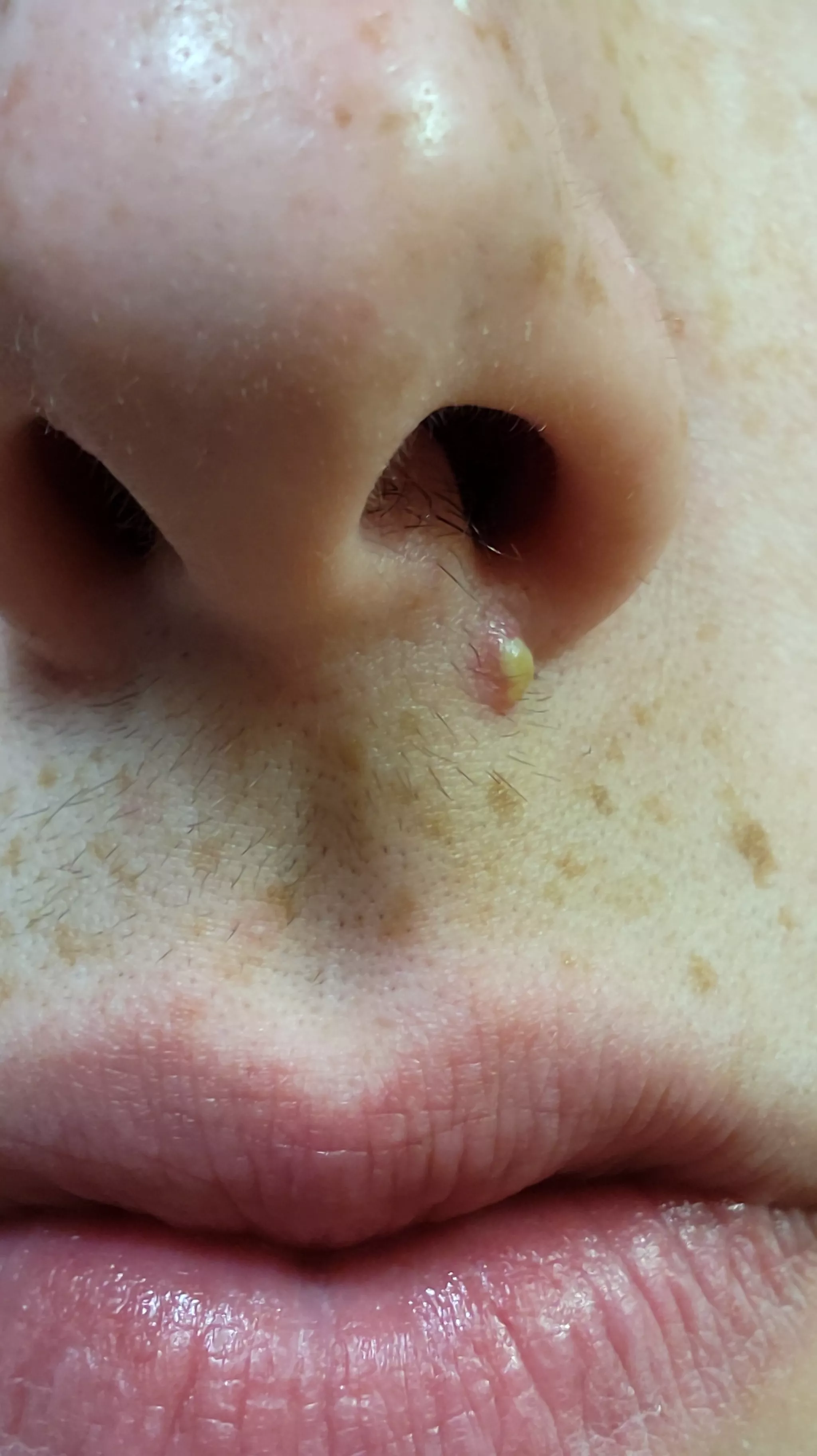 I have school and work tomorrow, would this be better or worse to pop it