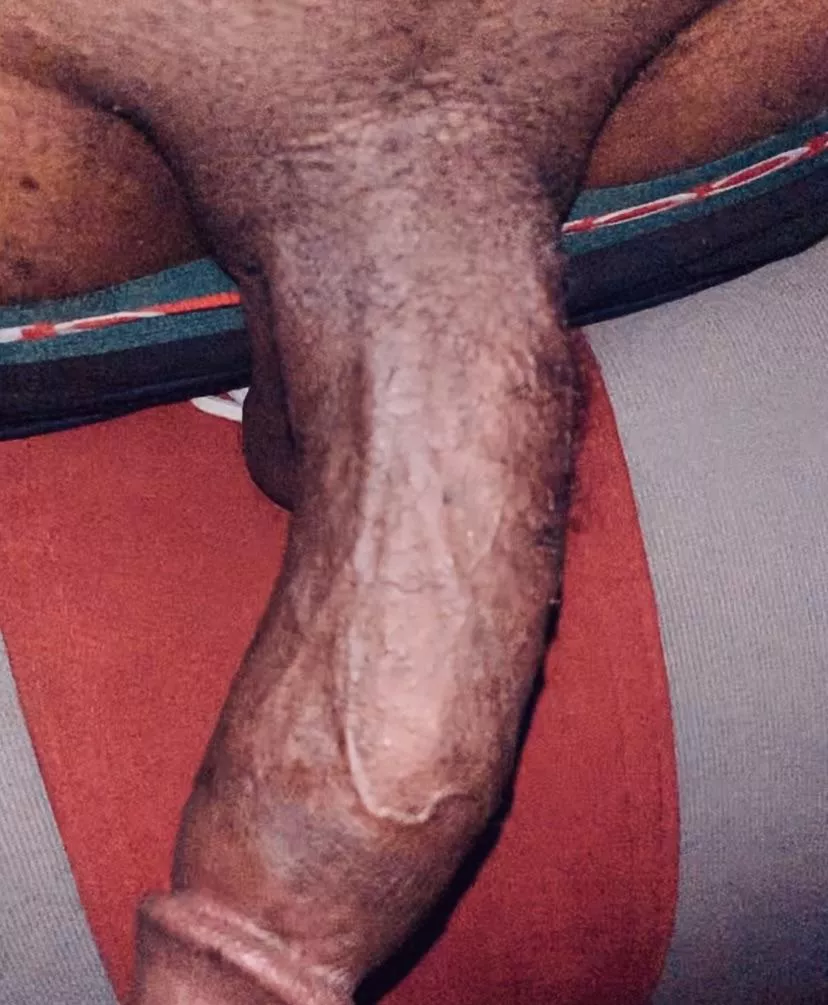 Any subs for long term?