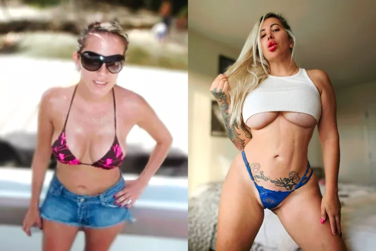 Before and after. Bimbo mommy now. Should I get bigger tits and more fillers?