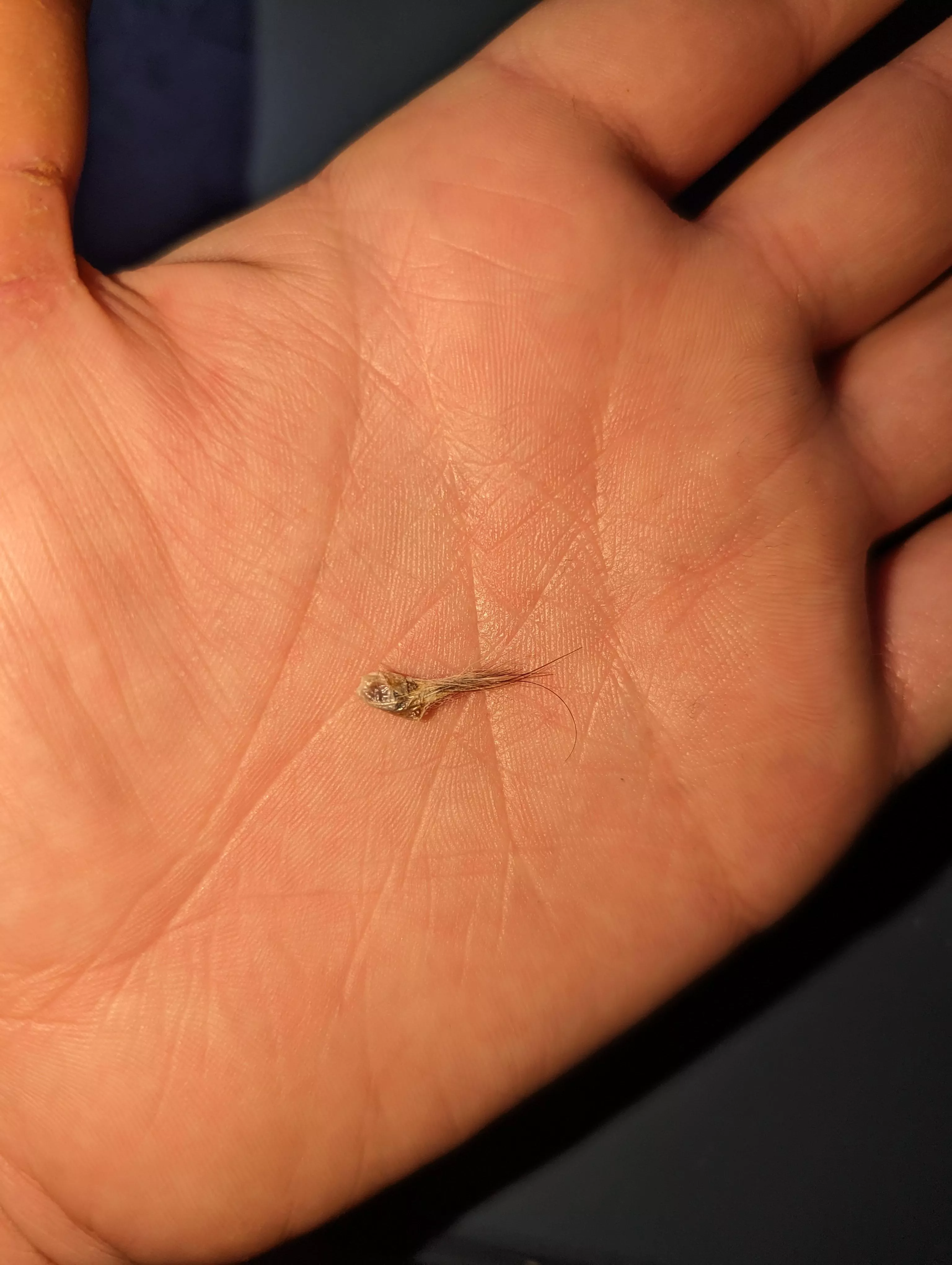 Just learned that navel stones are a thing after pulling this guy out of my bellybutton.