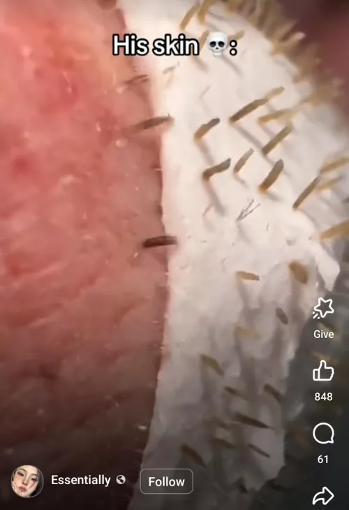 Is there a blackhead remover that does this? Saw this on FB but not clicking the link.