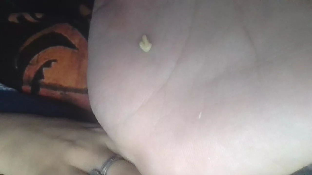 This really gnarly tonsil stone just popped out