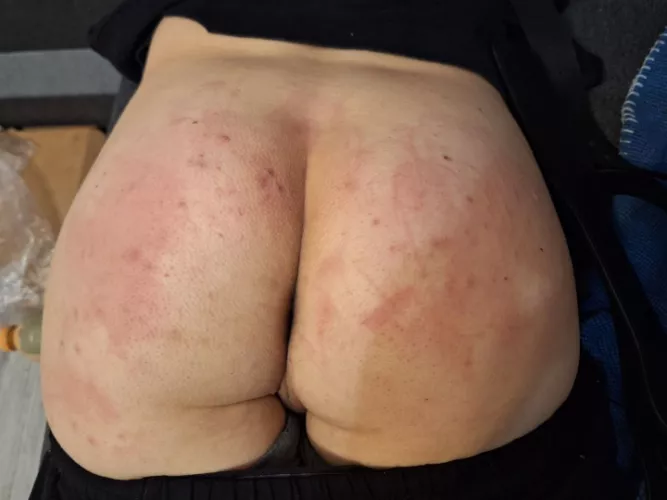 Aftermath of my first time getting spanked
