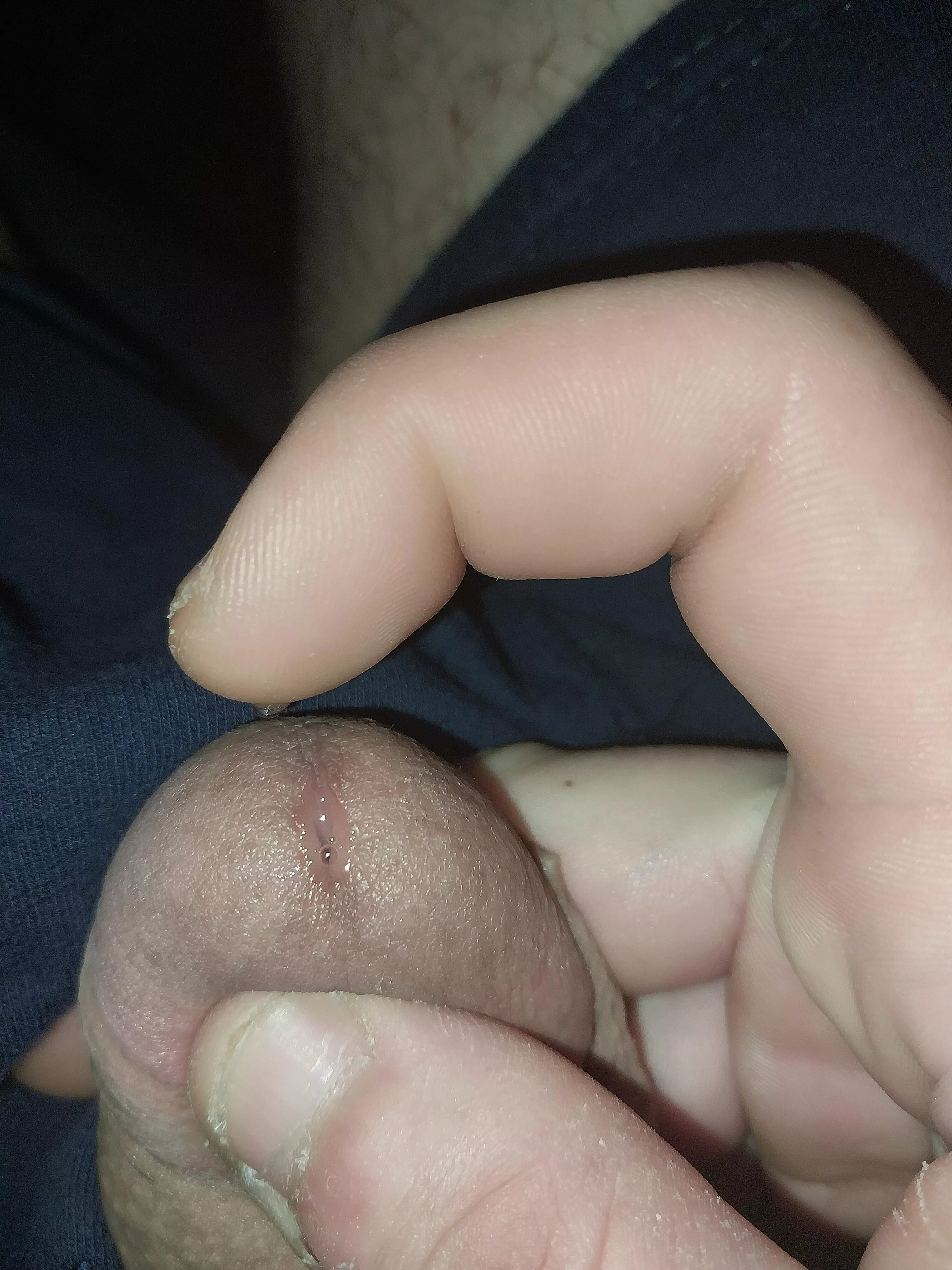 First, all apologies