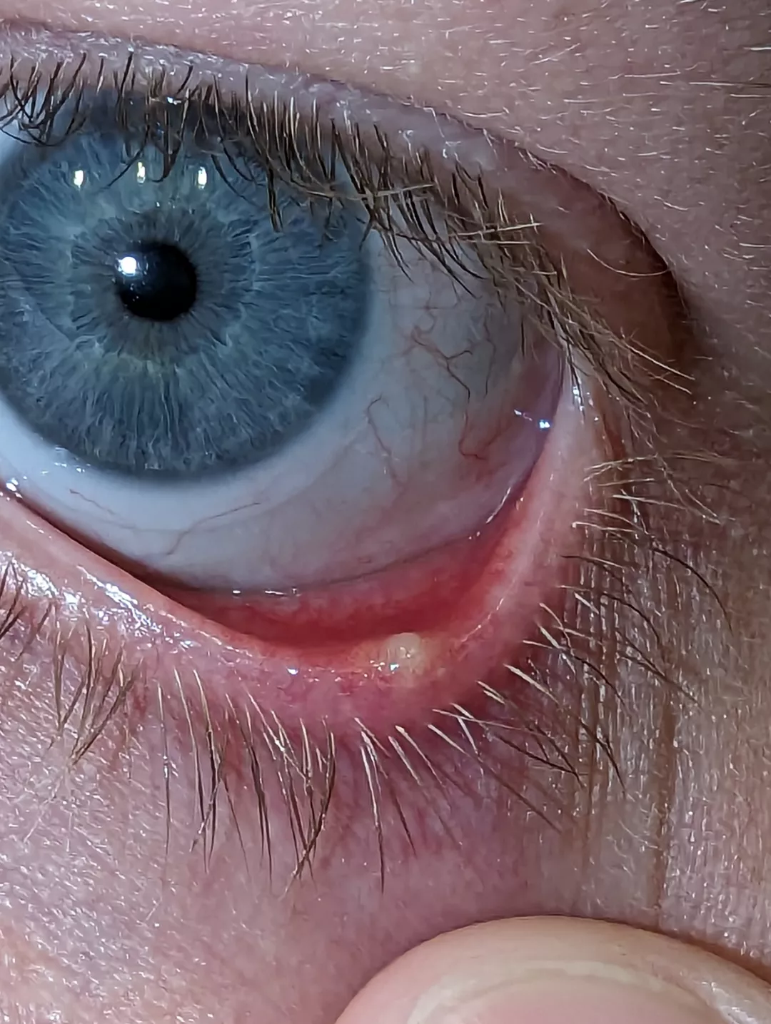 The Internet tells me not to do it....but damn do I want to.