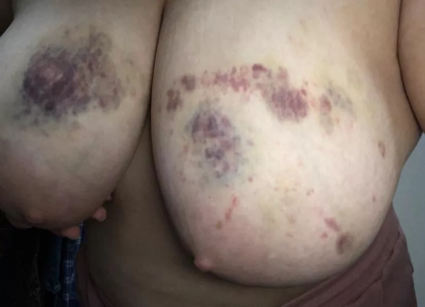 Tie me down and destroy all my virgin holes. I need the pain, and I can take worse than this