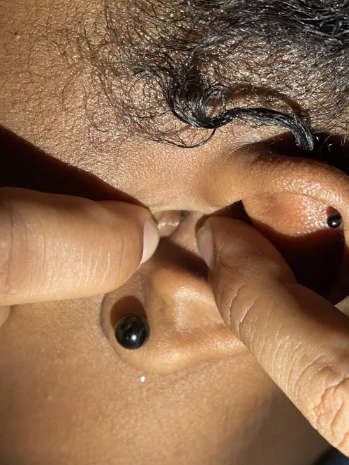 Difficult ear pop potential