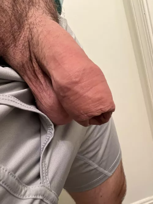 How’s it look for originally being circumcised?