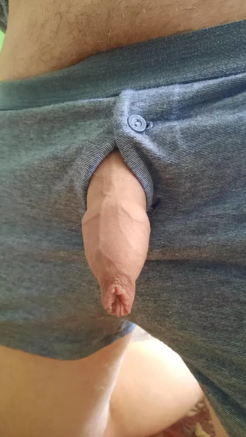 Enough foreskin for you?