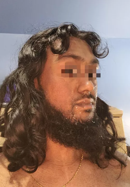 Had to share another self-glazed face