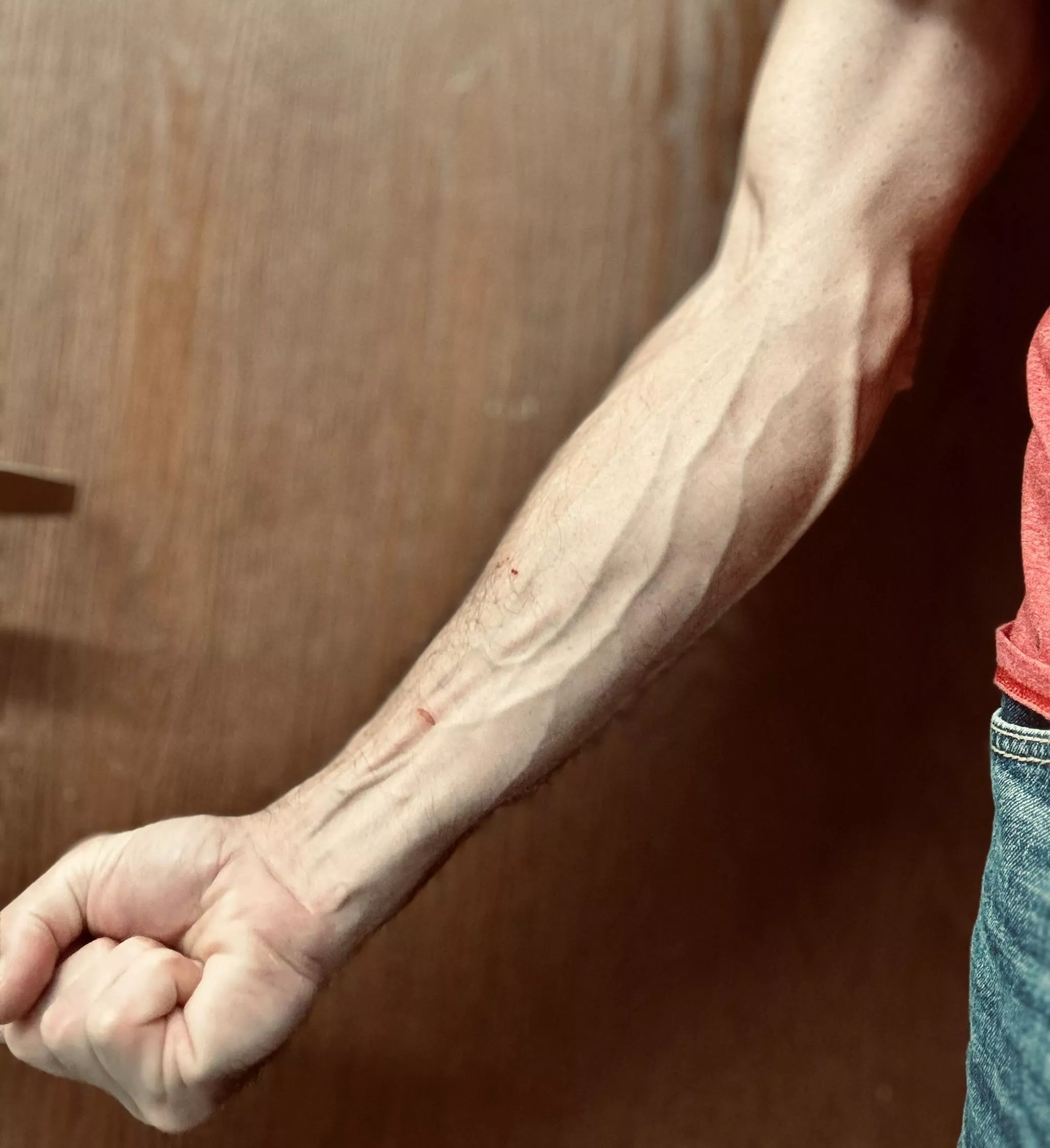 A few cuts and scratches just show that you worked today