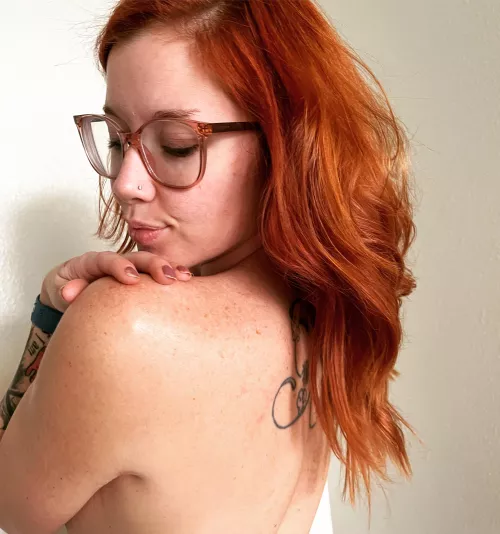 Guess how many freckles? The winner gets a date