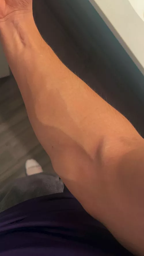 Nurses love me💉😂