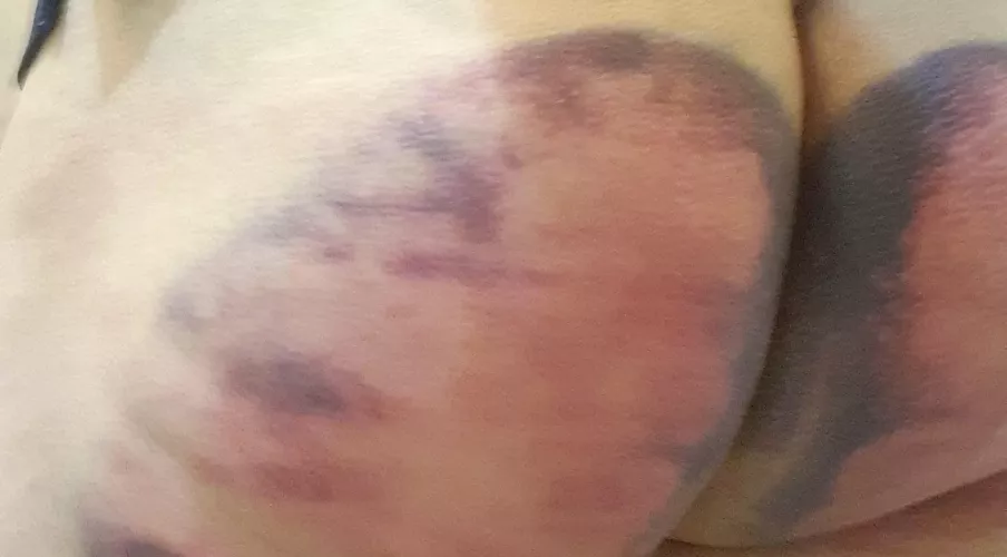Got my ass spanked at a local bdsm meetup