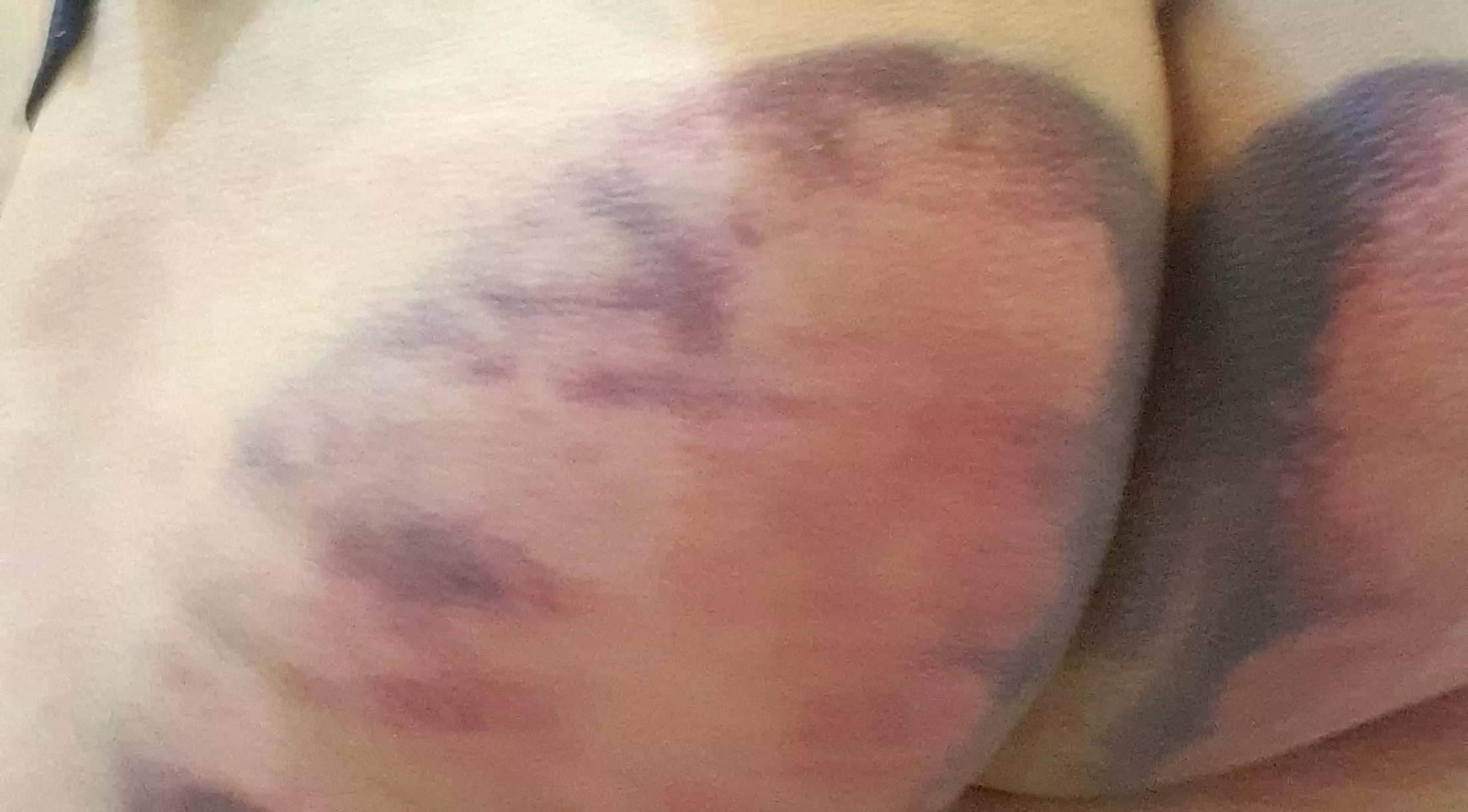 Got my ass spanked at a local bdsm meetup