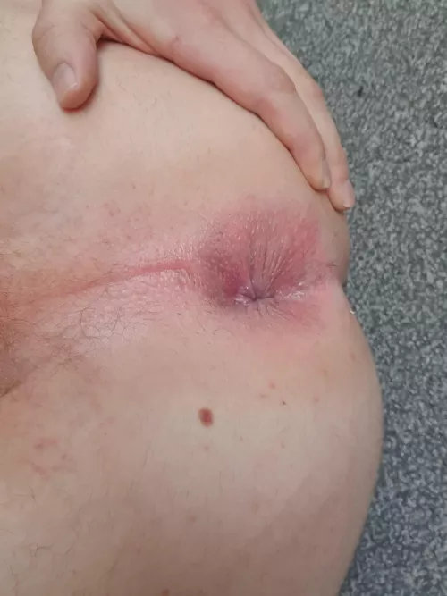 Guys like my beauty mark x