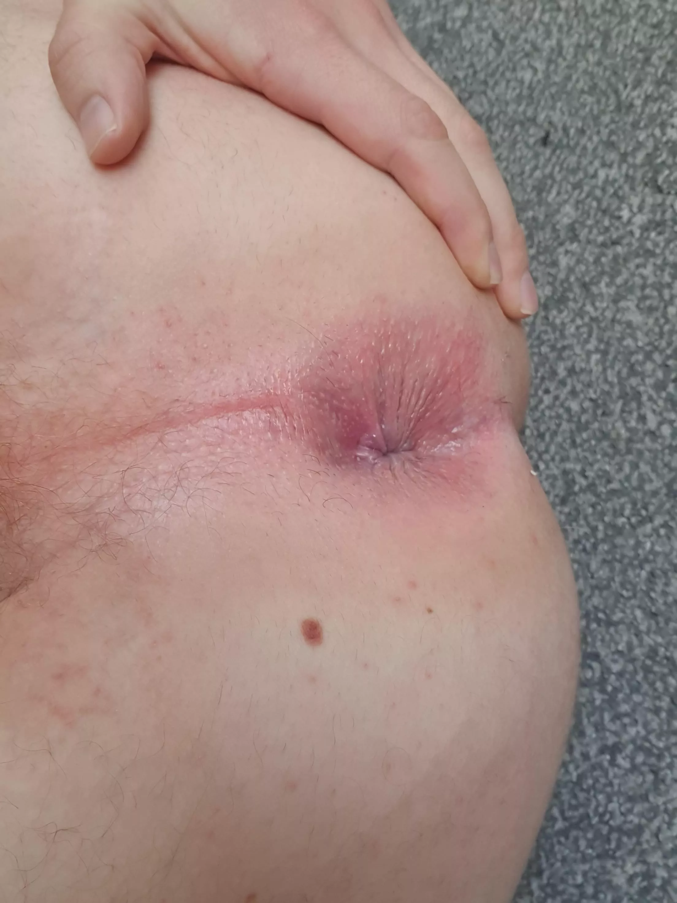 Guys like my beauty mark x