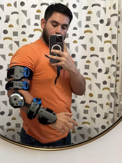 I tore my distal bicep tendon and I got surgery two weeks ago to repair it.