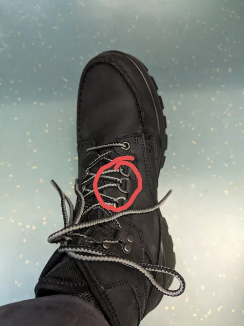 Feet hurting in this area!