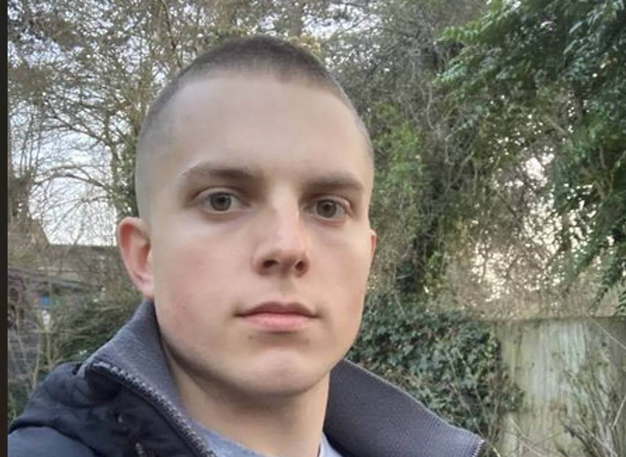 Hi guys! Really appreciate your perspective on that previous post! I once had my lips pierced like an idiot, but then had them removed, which has forever meant I am left with these ugly 'white' marks. I think they look weird AF. What that would be your Hi guys! Really appreciate your perspective on that previous post! I once had my lips pierced like an idiot, but then had them removed, which has forever meant I am left with these ugly 'white' marks. I think they look weird AF. What that would be your