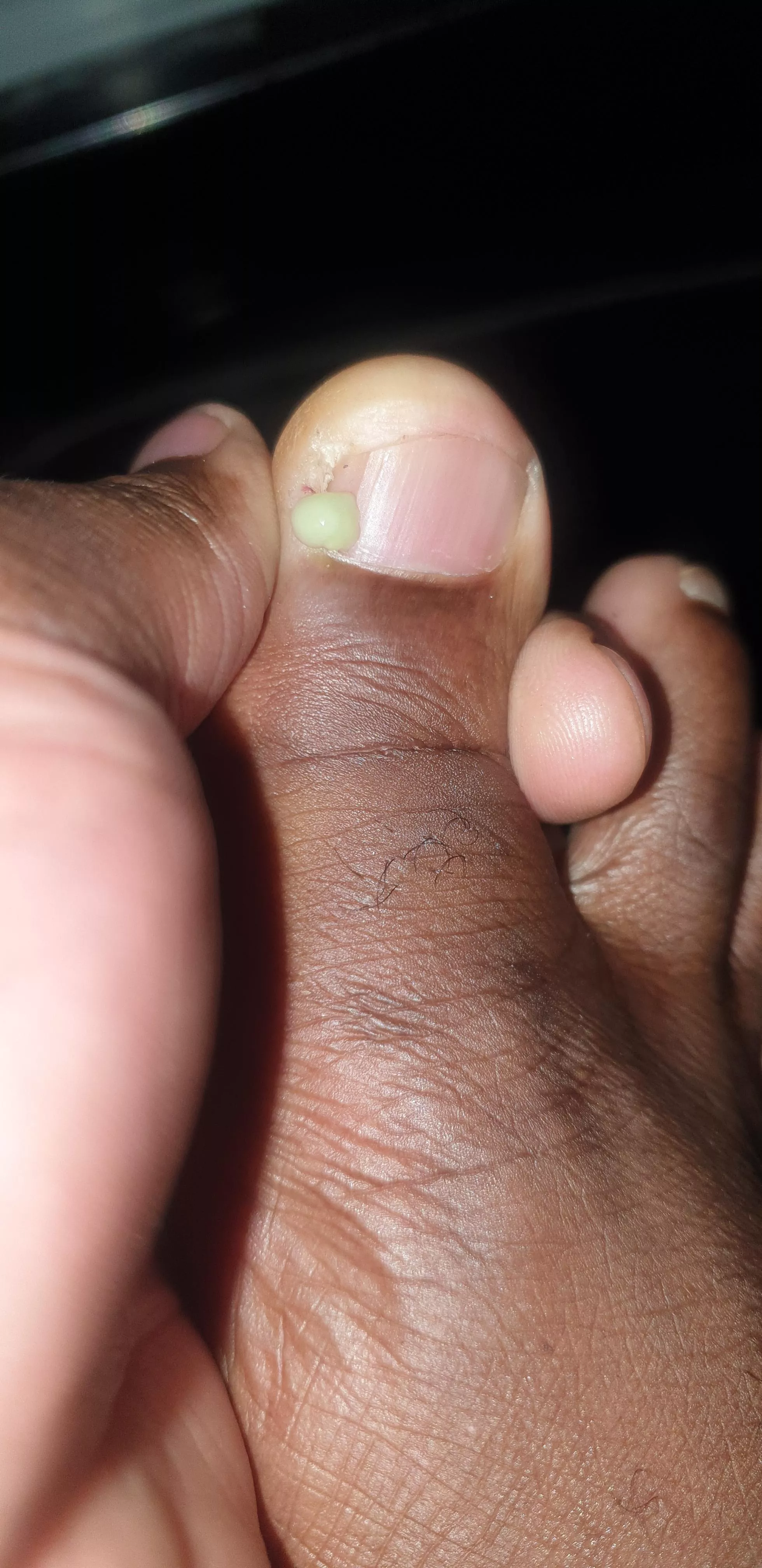 This happened, and wowzers