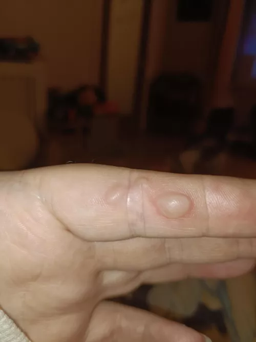 Forbidden bubble wrap.