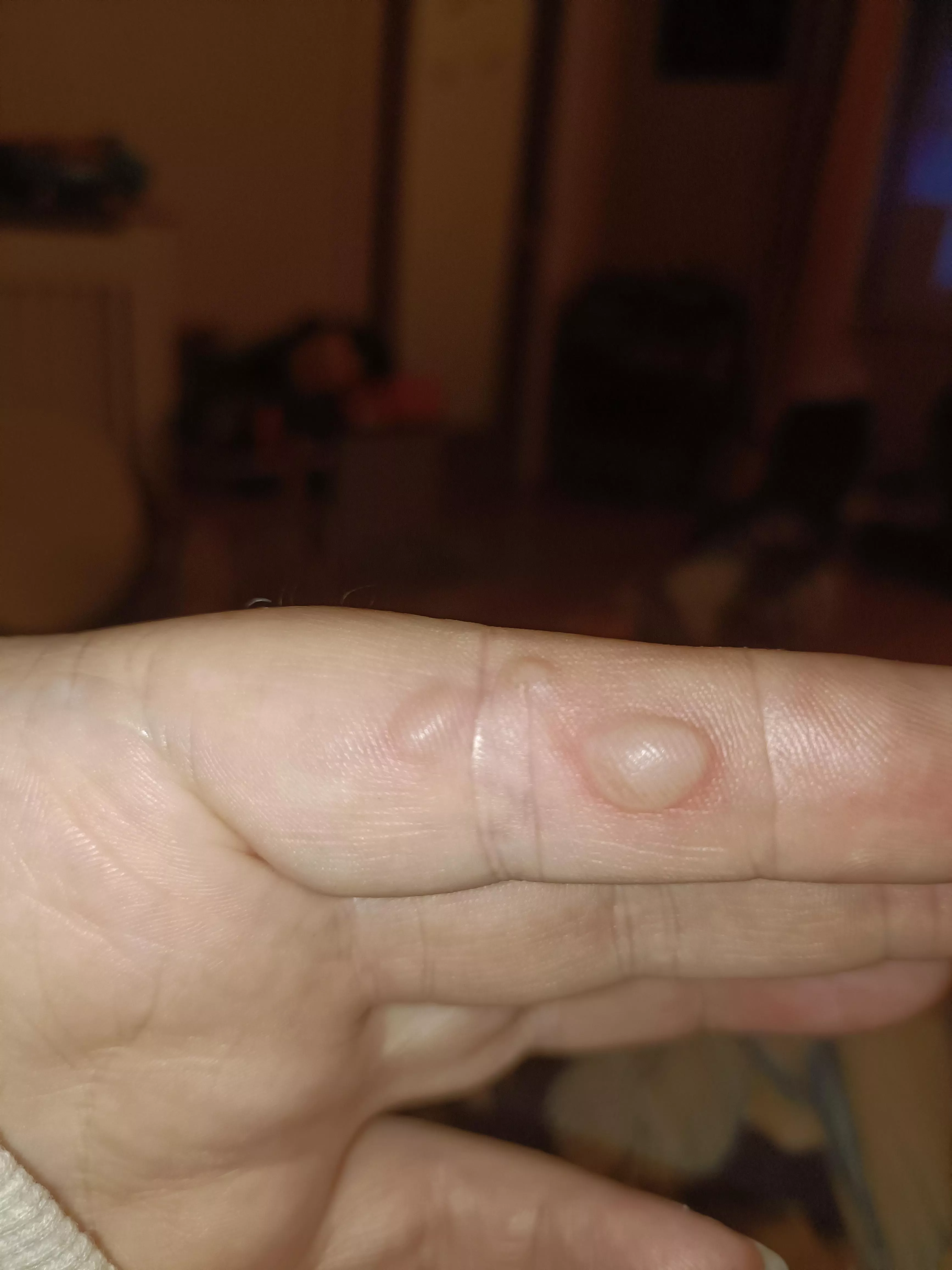 Forbidden bubble wrap.