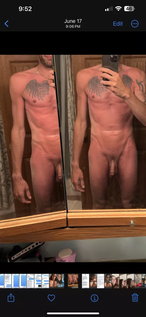 [m] 42. Bad sunburn I know….🙄