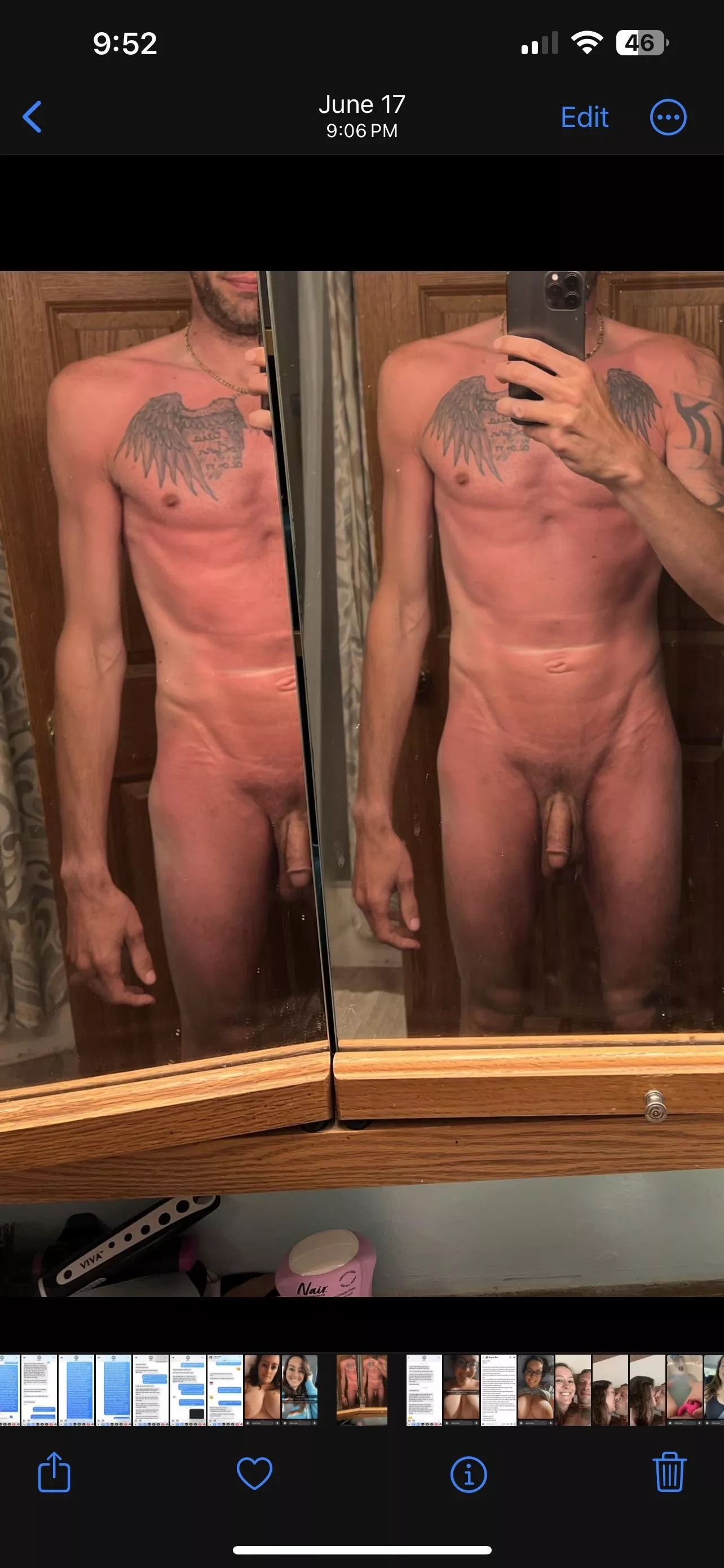 [m] 42. Bad sunburn I know….🙄