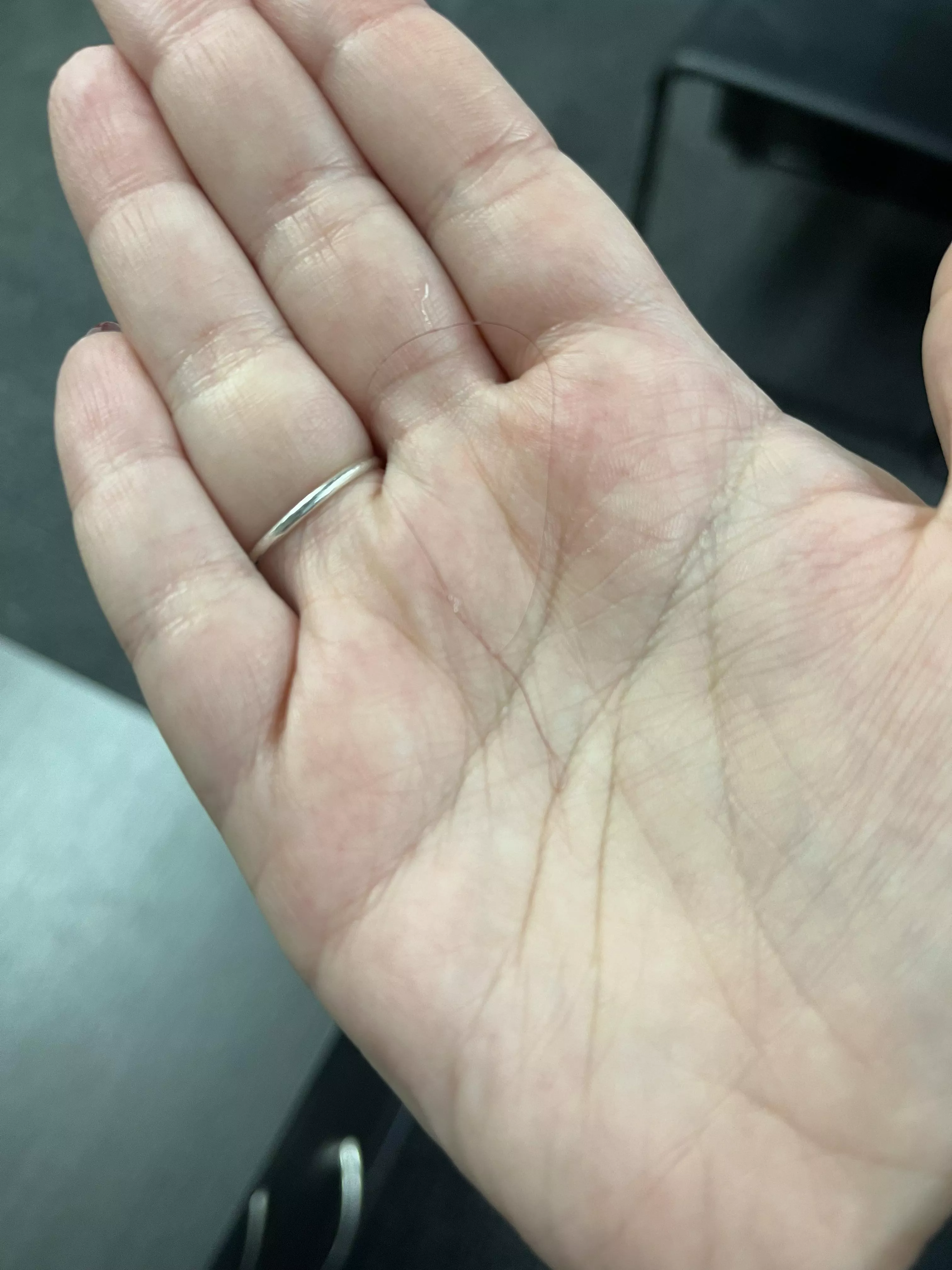 I pulled this from my left eye this morning and knew y’all would understand what I meant when I say the relief I felt was insane.